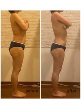 うつくし痩身 美サロン ゼットワン(Z-ONE)/ボディ　メディセル＋マッサージ