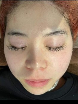 サラーム 沖浜店(Salaam)の写真/最新機器×ハンドのWアプロ-チ!お顔+顎下+首+デコルテの施術で,気になるお顔のホウレイ線/シワたるみにも◎