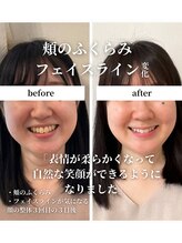 フェアリーフェイス 南森町店(Fairy Face)/小顔/自然な笑顔ができるように