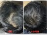 40代から本格育毛を促進するトータルケア