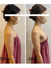 ロココ 豊田店(Rococo)/ビフォーアフター