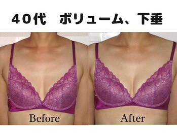 バストサロン メルベイユ(Merveile)/谷間・ボリュームUP