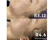 ビラ ベルダ(Bira Beldad)/