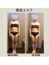 ムーン(MOON)/痩身エステ全身