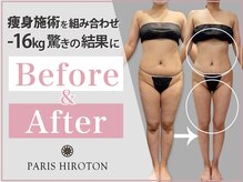 パリスヒロトン(PARIS HIROTON)