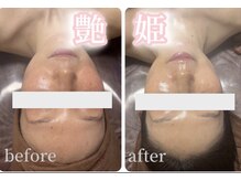 サロンデュ ひゃーく(Salon du ひゃーく)/～赤ちゃんみたいなつるん肌へ