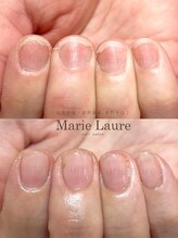 マリーロール 淀屋橋本店(Marie Laure)/自爪育成/深爪矯正/ネイルケア