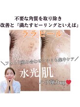 ダイヤ 名古屋中川区店(Daiya)/■ララピール/美肌根本ケア