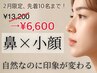 【2月限定、先着10名！】美鼻＋輪郭・小顔矯正¥13,200→¥6,600◇◆ 【小顔】