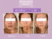 ラトナ(Ratna)の雰囲気（エステ超えの結果＼小顔美肌フルオーダー／）