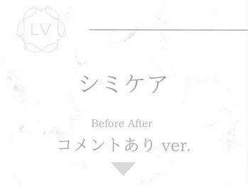 ラヴィオーラ 栄(LV)/ダイヤモンドハーブピーリング
