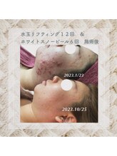 プリマプリート 各務原店/白玉スノーピール+水玉LDM