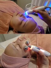 ビューティーストーリー 本店(BeautyStory)/フェイシャル人気No1メニュー