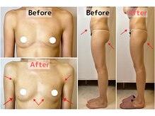 ロットプラス(Lot Plus)/Before→After（約3ヶ月の変化）