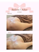 ロココ 安城店(Rococo)/バストアップ症例