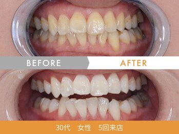 ホワイトニングセンター 札幌白石