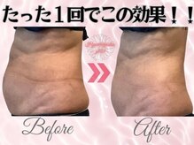 ワイキューマルサン(y903)/たった１回でこの効果☆