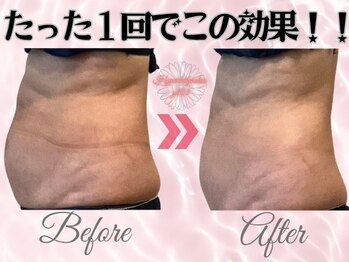 ワイキューマルサン(y903)/たった１回でこの効果☆