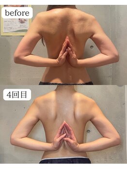 ロータス(Lotus)の写真/大事な日を控える貴女へ！姿勢・生活習慣のアドバイスまで丁寧にサポート。見とれるような背中美人に◎