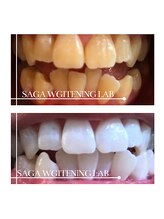 佐賀ホワイトニングラボ/