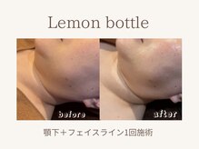 ビーモア(B.MORE)/韓国美容｜レモンボトル