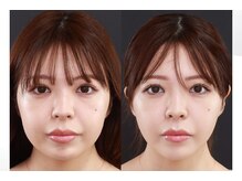 アンベリ(Embelli)の雰囲気（一人一人のお悩みに丁寧に寄り添うカウンセリング◎）
