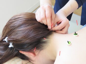 代々木オナハン鍼灸整体院(ONAHAN)/首肩こり