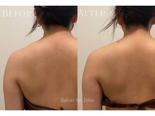 サロンドジョリー(Salon de Jolie)/【ボディウィンバック】