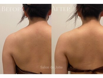 サロンドジョリー(Salon de Jolie)/【ボディウィンバック】