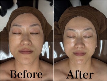 ラ ブリエ(La Briller)/一回で変化を感じる顔ツボ！