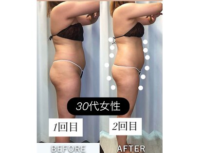 レチカ(Rechica)の写真