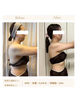 ヨサパーク オヨウ 荏原中延(YOSA PARK Oyou)/よもぎ蒸し/痩身/リンパ