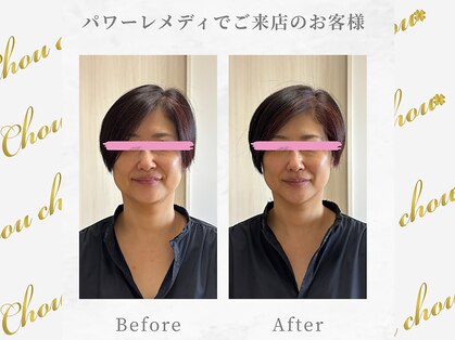 シュシュ(Chouchou)の写真