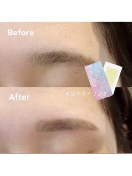 ビオラス(Biolus)/【眉毛/まゆげ】Before/After