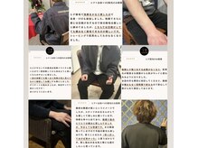 男性のしっかりした毛に効果抜群な脱毛機でご希望の仕上がりへ