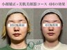 【小顔への最短ルート☆】小顔矯正+美肌美顔器４回モニター¥44,000→¥22,000