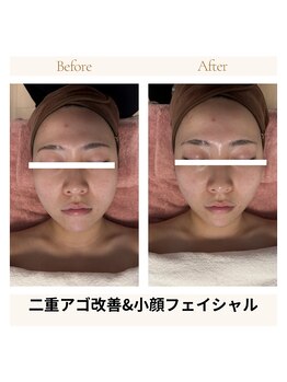 カモミール(Camomille)/二重アゴ撃退＆小顔フェイシャル