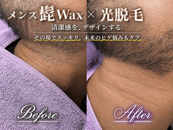 グリッター 泉中央店(GLITTER)の写真/ワックスで頑固な毛も根本から取り除き剃った後のチクチク感が無い★このツルツル感はWaxでしか味わえない!