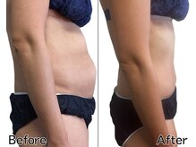 サロン ド エゴット(Salon de Egotto)/キャンペーン