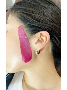 エミュー(Emyu)/【Wax脱毛】VIO+顔