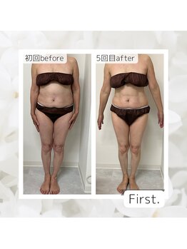 ファースト(First.)/