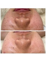 ルコア ドゥ(rucor doux)/肌悩みだけじゃない！