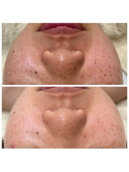 ルコア ドゥ(rucor doux)/肌悩みだけじゃない！