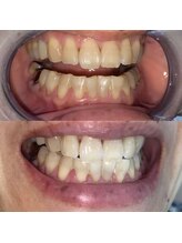 ライトビューティー 池袋店(LightBeauty)/症例写真