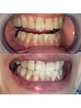 ライトビューティー 池袋店(LightBeauty)/症例写真