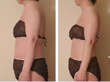 マナ(mana)/たった1週間のホームケアで変化