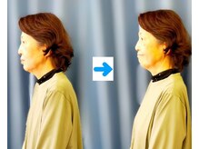 いのくち接骨院/姿勢改善の症例