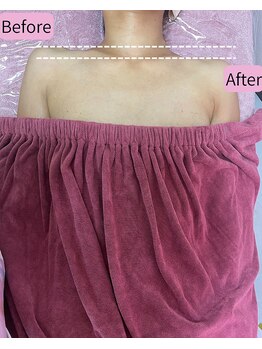 チュラ 大宮店(Chura)/肩の位置に驚きの変化が!