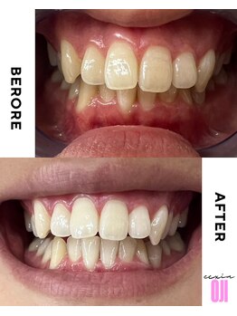 エクシアホワイトニング 王寺店/