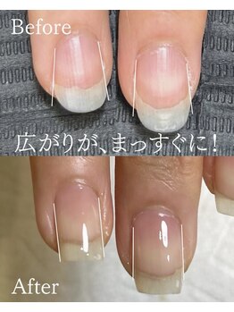 アーク(arc)/お爪は変わらないと諦める前に